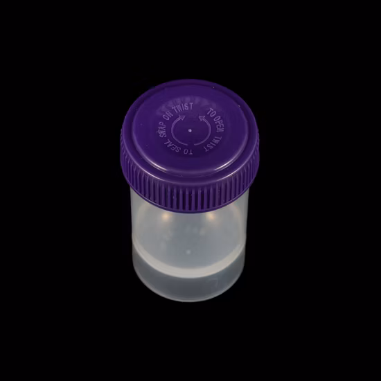 40ml Specimen Container /Urine Container Conical Bottom